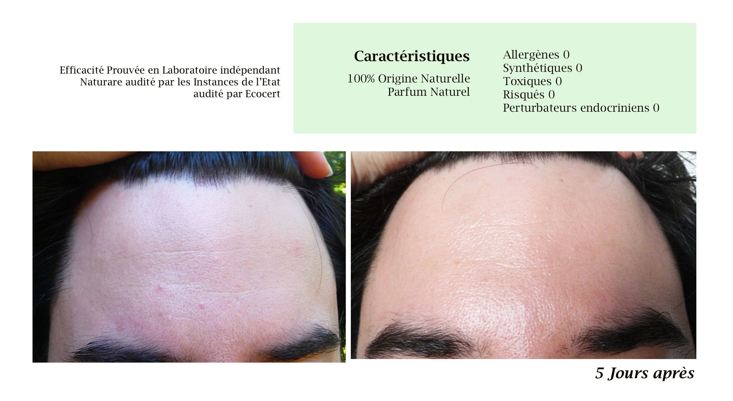 DROP - MERVEILLE DES LANDES ORGANIC - Sensitive Skin Care Complete Regeneration